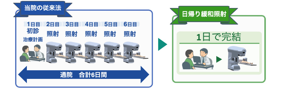 従来の治療法と「IMRT」の照射比較